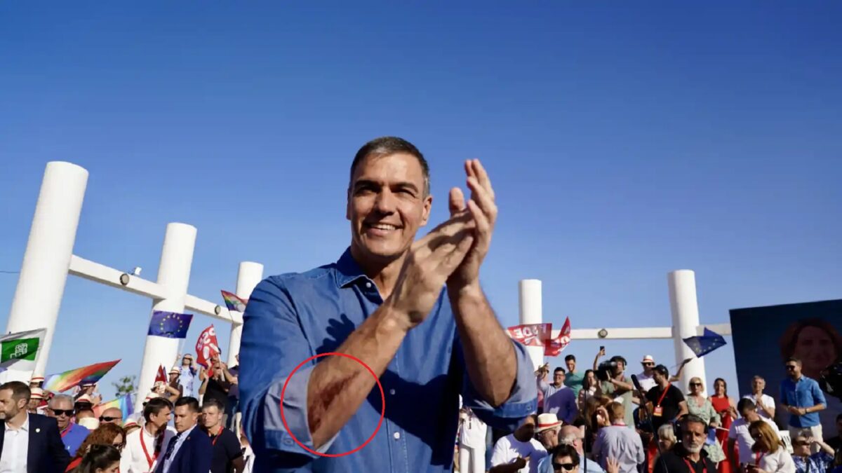 Pedro Sánchez con una herida en el brazo - Política