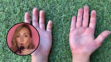 Irritación de los dedos de los niños, según una podóloga experta