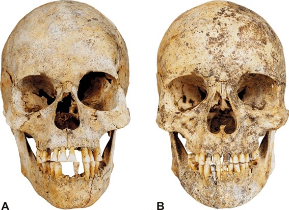 Cráneo de hembra H2a enface ( A ) y cráneo de hembra H1 enface ( B ) (F. Fojtík)