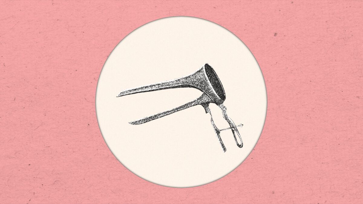 Espejo vaginal
